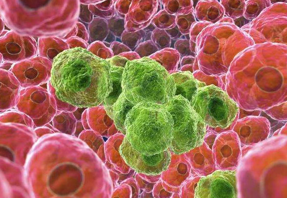 新研究促进对癌细胞全面遗传学研究