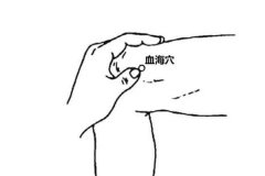 春季易过敏，可艾灸这3个穴位