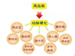 高血脂这4种食物要克制