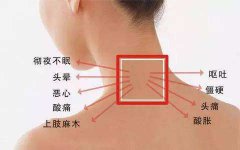这样自测颈椎病